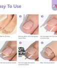 Ingrown Toenail Corrector Kit (Ships to US Only)