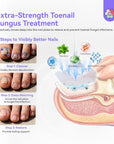 Advanced Toenail Fungus Treatment for Damaged Nails