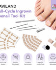 Ingrown Toenail Corrector Kit (Ships to US Only)