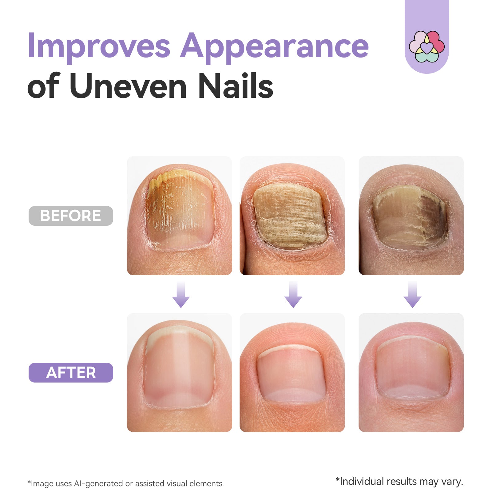 Extra-Strength Day &amp; Night Antifungal Toenail Care System