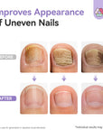 Extra-Strength Day & Night Antifungal Toenail Care System