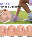 Ingrown Toenail Corrector Kit (Ships to US Only)