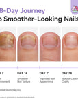 Extra-Strength Day & Night Antifungal Toenail Care System
