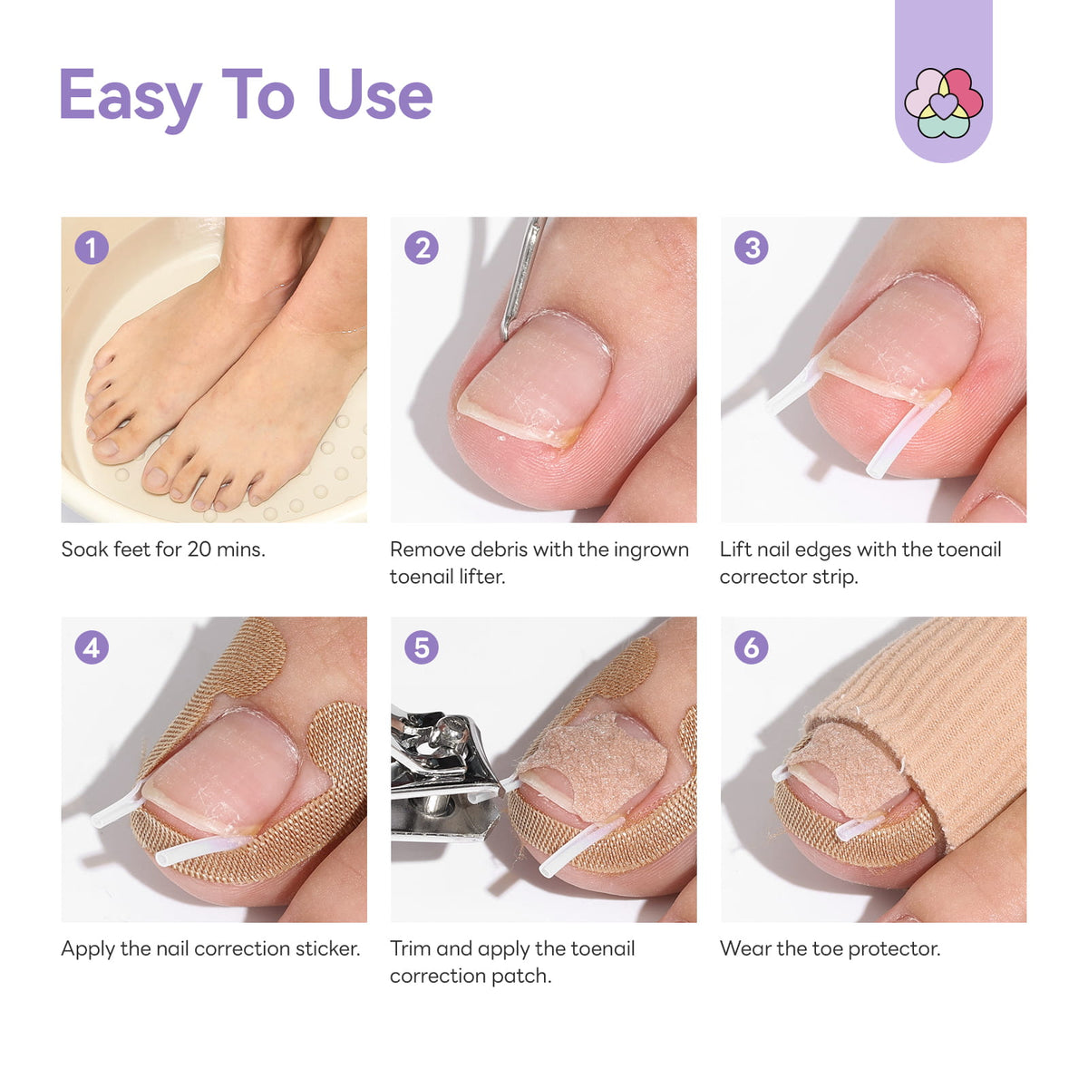 Ingrown Toenail Corrector Kit (Ships to US Only)