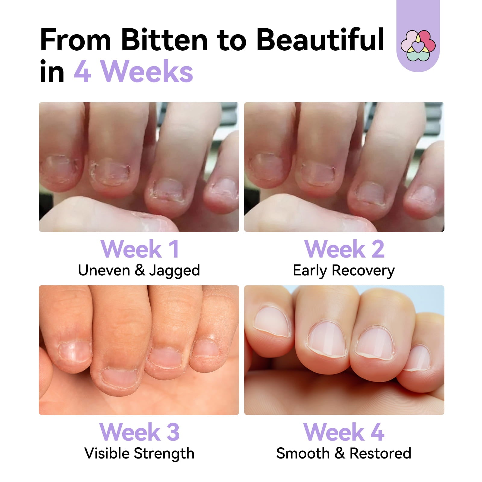 Stop Nail Biting Fast ¡§C Extra Bitter Repair Pen for Adults
