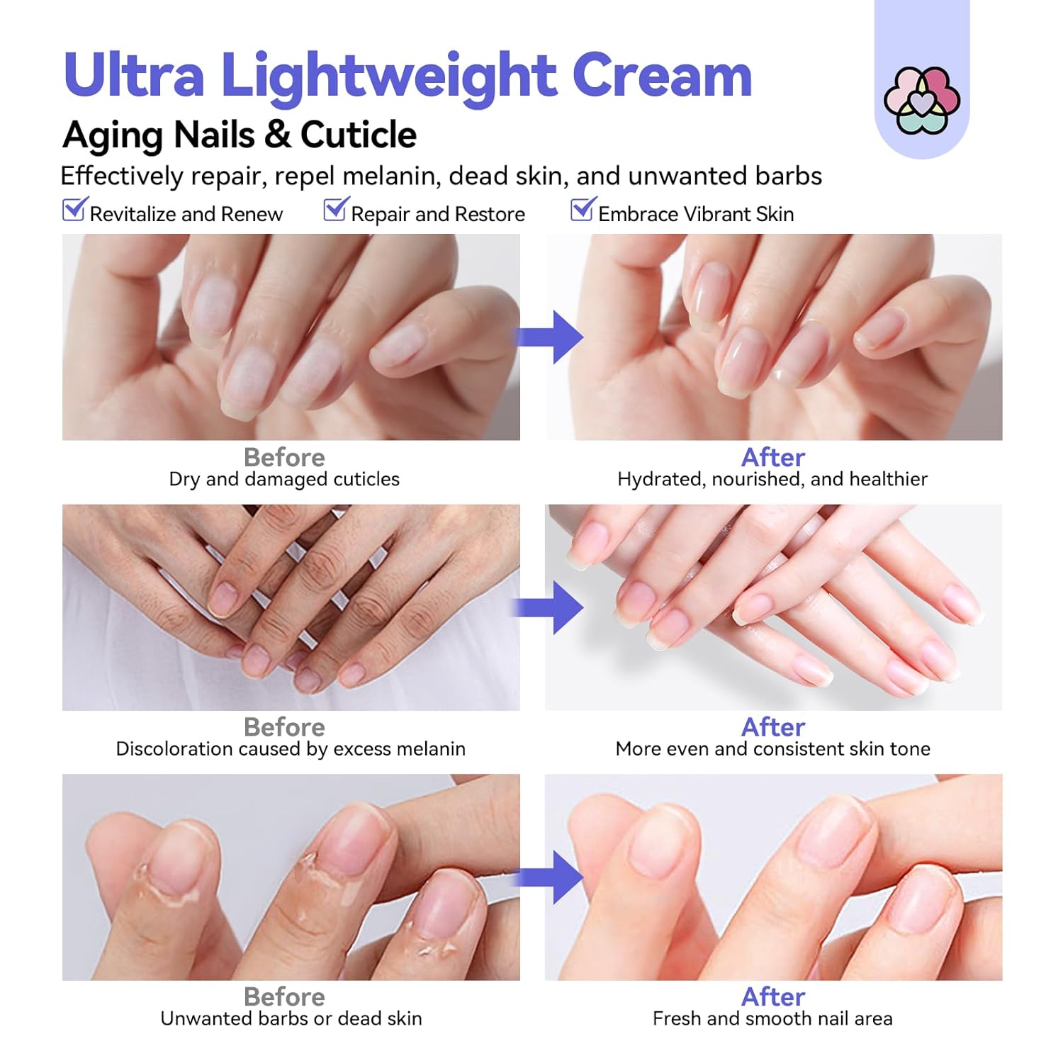 Ultra Repair Cuticle Cream for Dry Damaged Nail Care (Ships to US Only)